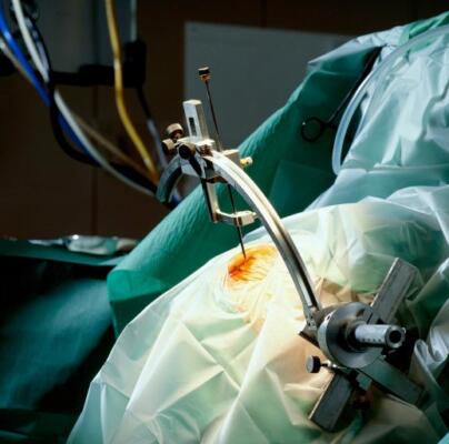 biopsy