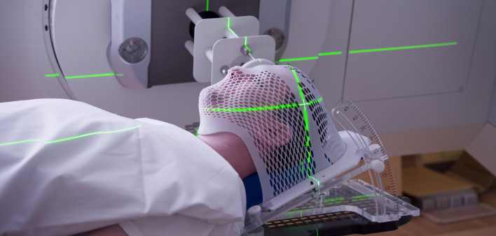 radiation therapy