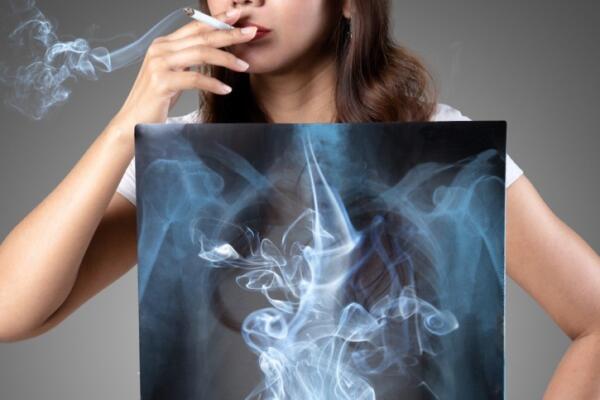 smoking X ray